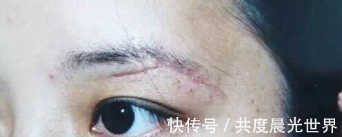 女生|为什么不建议女生纹眉内行人说出“实情”，看完再做决定也不晚