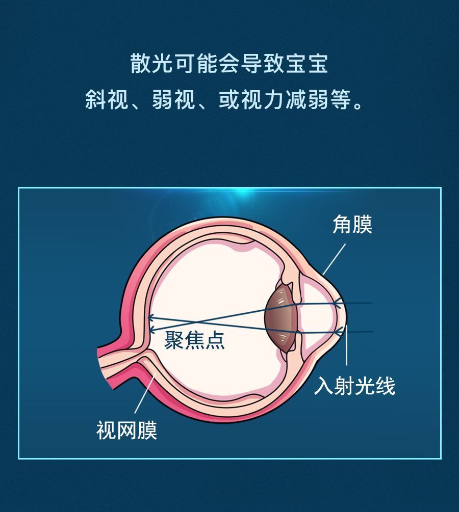 戴眼镜|从小忽略这件事,难怪宝宝3岁戴眼镜