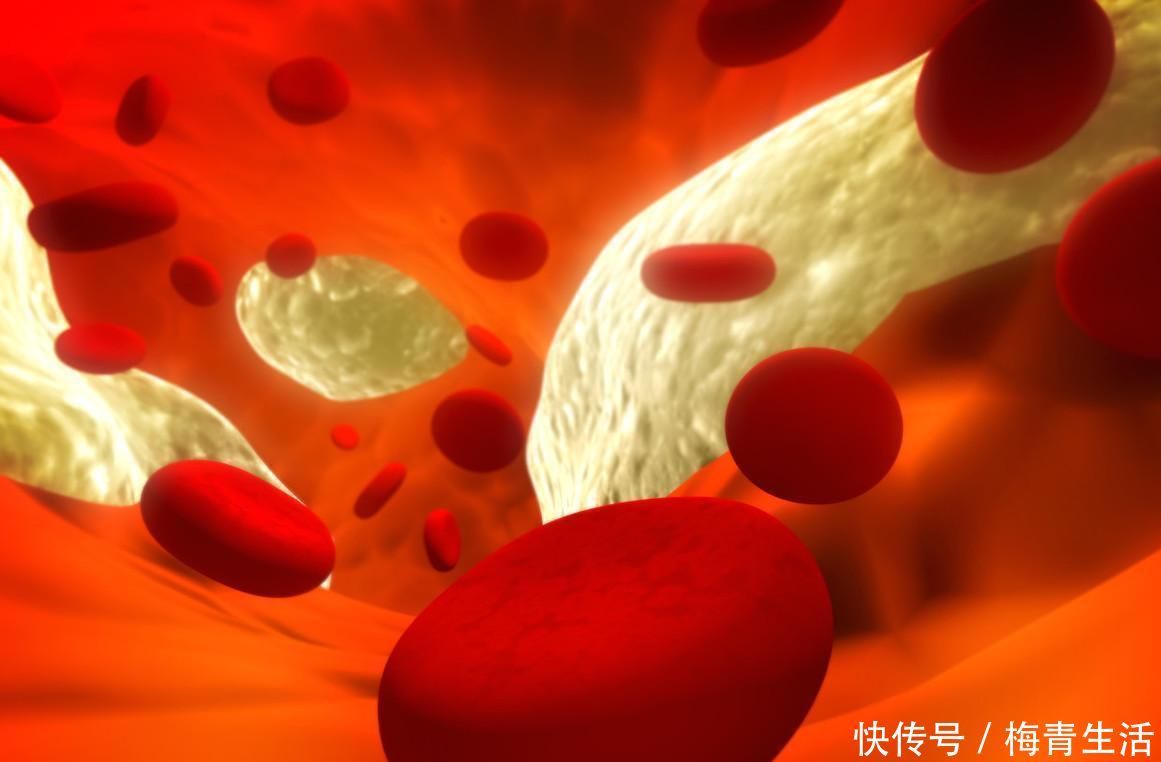 血管堵塞|血液有多稠，睡觉能知道，睡觉时出现的3个表现，或是血管堵了