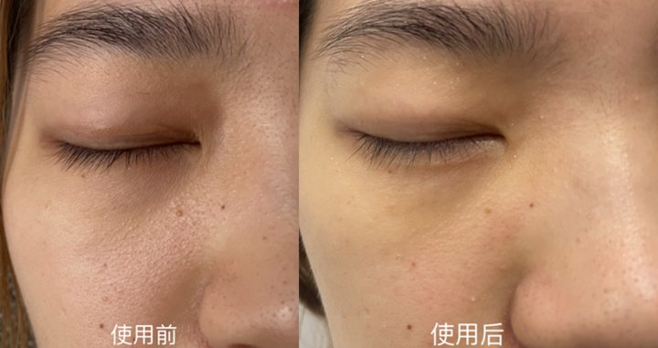 精准|功能型面膜VS补水面膜，精准和精简之间你选对了吗