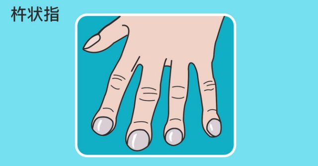 吸烟者没办法戒烟，常喝2水吃2草，排除烟毒，肺更健康