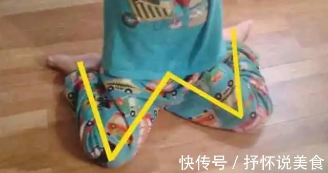 受压|8岁男孩脊椎侧弯,只因家人常做这个动作,这个错误,90%的父母都在犯