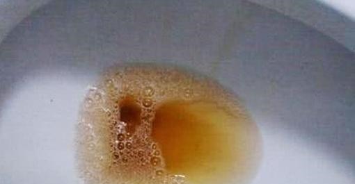 豆奶|早上是养肝的黄金时间,多吃4种食物,肝脏会更健康