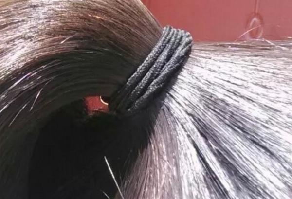 生活小窍门:如何去头皮屑!有头皮屑的朋友建议收藏!