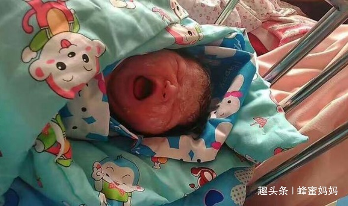 肚子|产妇刚生完娃,肚子仍“鼓的”像怀孕8个月,医生手术后对不起