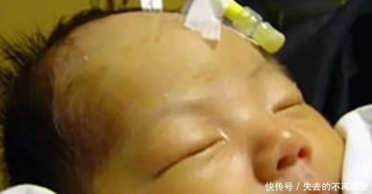 怀孕期间|儿科医生:想要孩子出生没黄疸,孕期得坚持“三不做”,别不信