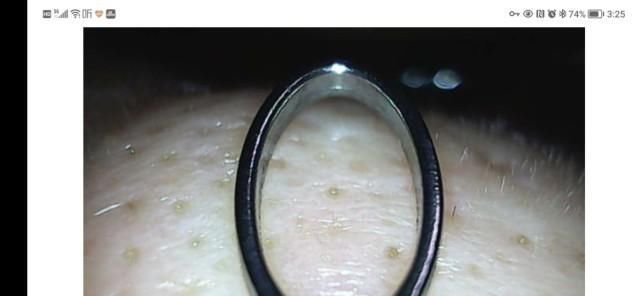 青春|洁净看得见,让青春轻松战“痘”: 媄拾智能可视毛孔清洁仪