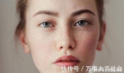 不良习惯|三位院士建议:祛斑其实很简单,2种食物换着食,色斑绕你走