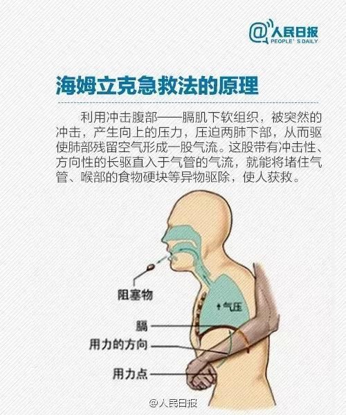 多个孩子被噎身亡！家长要看：“剪刀、石头、布”关键时刻能救命