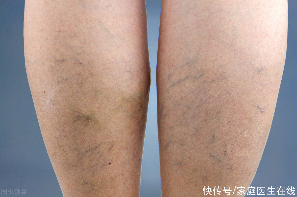 坐多久才算久坐?它不止伤腰那么简单,这6大危害要警惕了