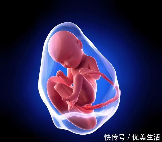 脐带绕颈怎么办?孕妇要改掉这4个行为