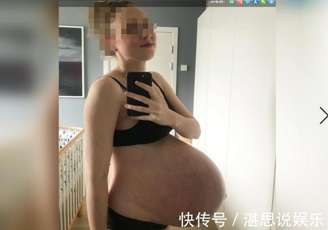 肚形|孕妈晒“悬浮肚”走红，人人说是双胞胎，孕妈遭遇让人心疼又担心