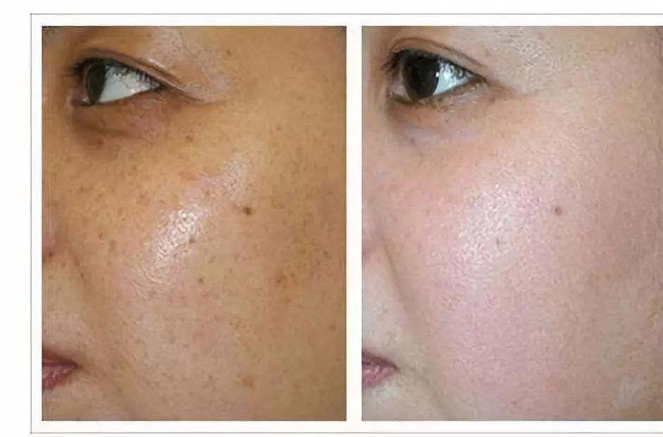 脸上暗沉无光泽特别蜡黄怎么办?这些有关提亮肤色的技巧记得收藏