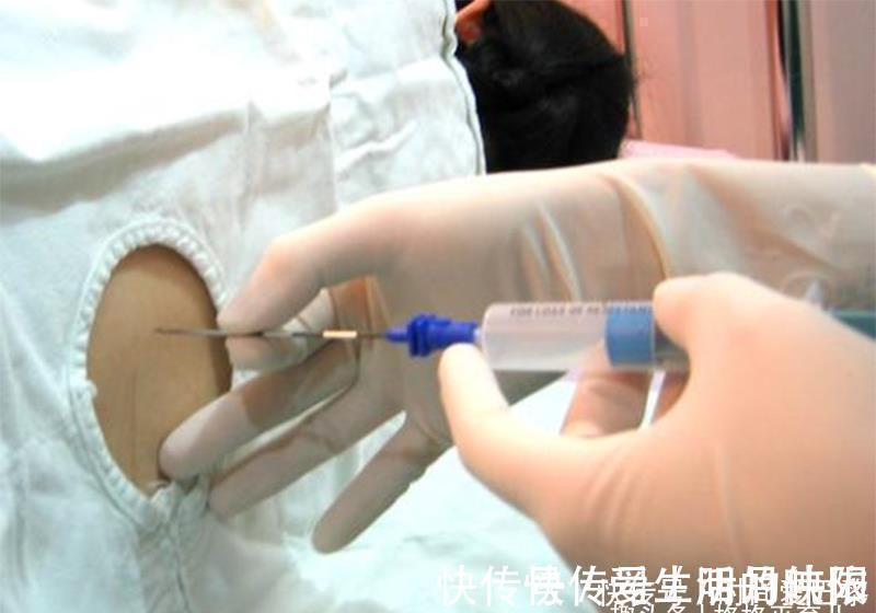 肚子|剖腹产只是“挨一刀”吗?术后恢复期有哪些要注意的?