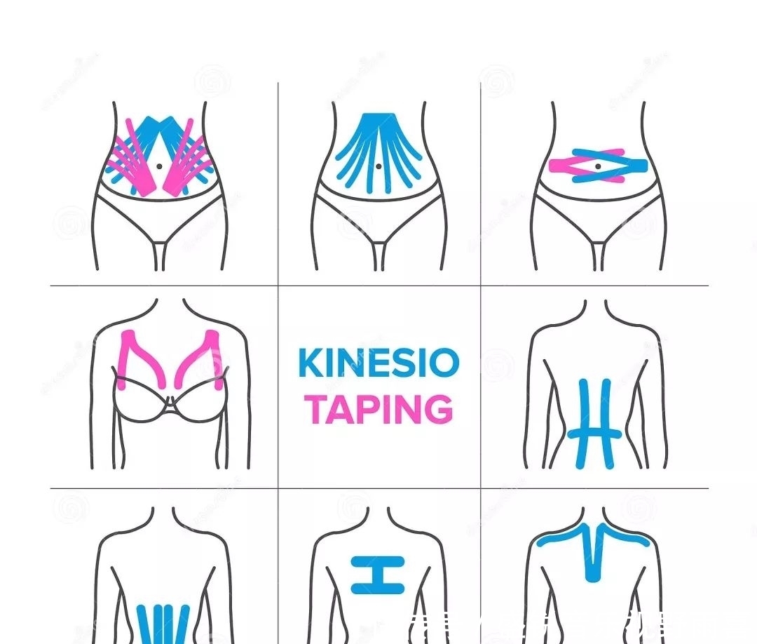 图片|一分钟学会使用肌效贴(图片+视频教程)