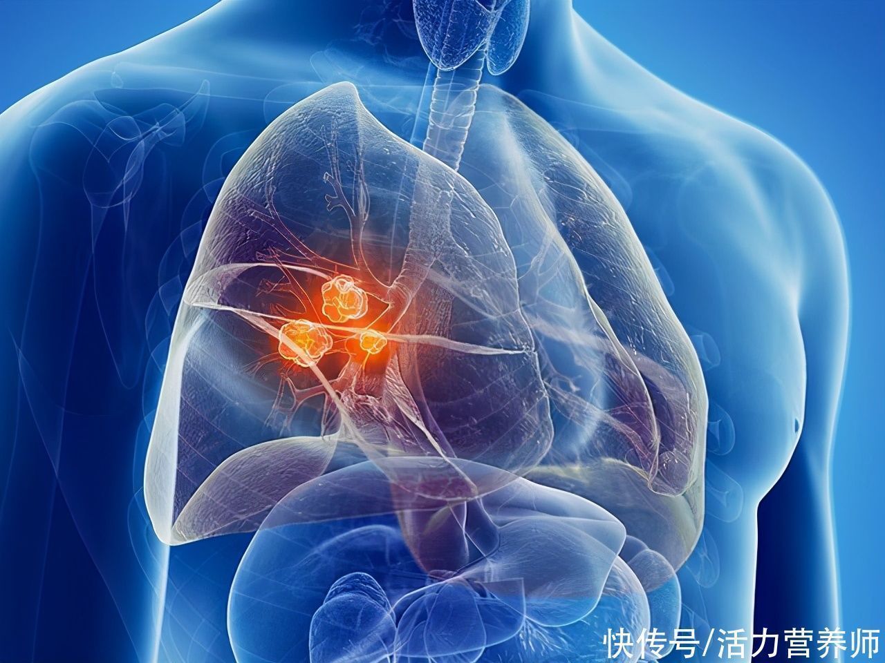 肺癌|肿瘤科医院专家表示:这几种癌症是“过于节省”导致的,要大方点