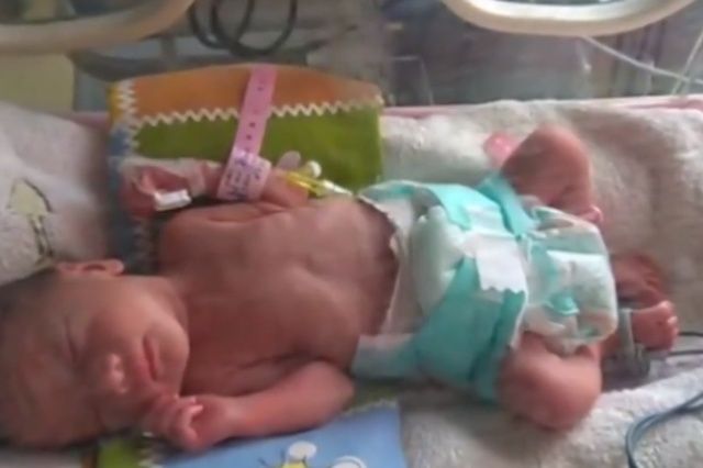 妻子|30岁孕妇被查出患癌，为孩子她坚持保胎，丈夫却说：两个人都不要