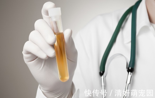 降血糖|糖尿病患者，多吃粗粮能降血糖？医生：这4种粗粮要少碰，升糖快