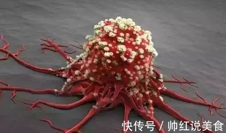 大闸蟹|聂卫平抗癌8年至今无复发,从癌症晚期到肿瘤消失,2件事是关键