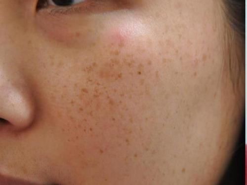 内分泌|女性有7种“丑态”,或在暗示内分泌失调!坚持好习惯,气色更佳