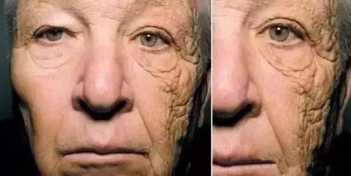 部位|很多人全身防晒，却漏掉了这个部位，后果多严重你知道吗？