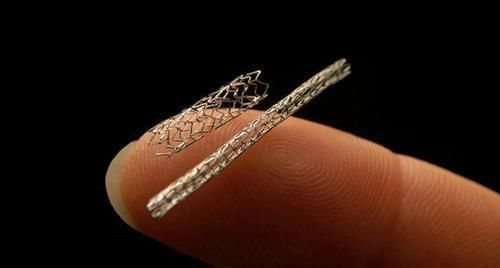 心脏支架|心脏支架手术后,还可以活多久医生终于给出准确答案,早做准备