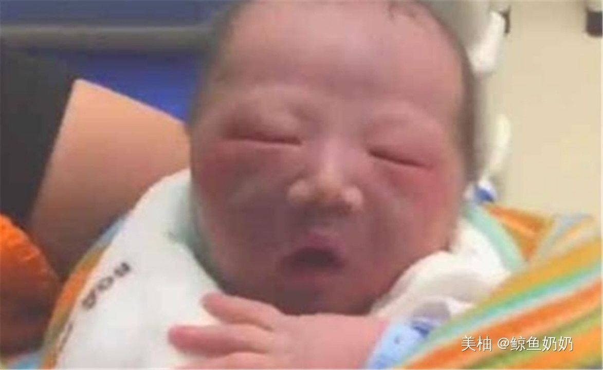 护士|丑娃出生连亲妈嫌弃，护士却夸漂亮，一个月后宝妈连连感谢