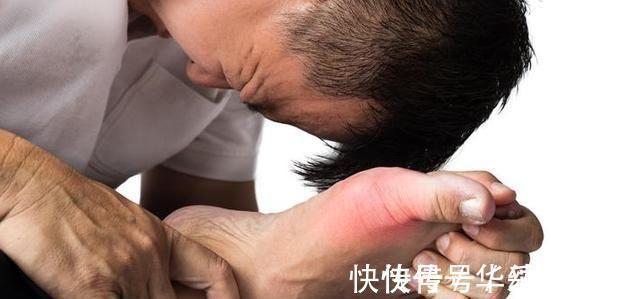 食物|“嘌呤大户”被揪出，宁愿不吃，也别碰这些食物！有你爱吃的吗？