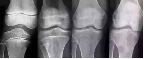 豆浆|10个孩子8个“早熟”,别再怪豆浆奶粉,“元凶”就在家里