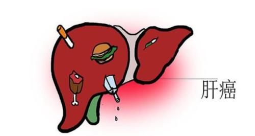 郁金|肝不好的人，试试老中医留的疏肝方，清热解毒，肝脏健康强壮