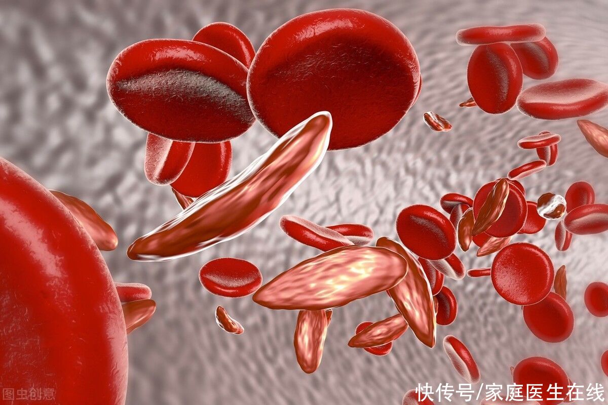 关键|不想被胃癌盯上而不自知？这5个早期症状要牢记，做好预防是关键