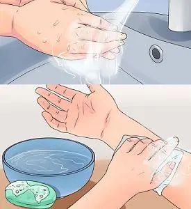 包扎|你真的懂如何包扎伤口吗？