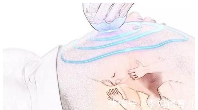 四维彩超|四维彩超不好过?医生:那是你没有提前了解注意事项