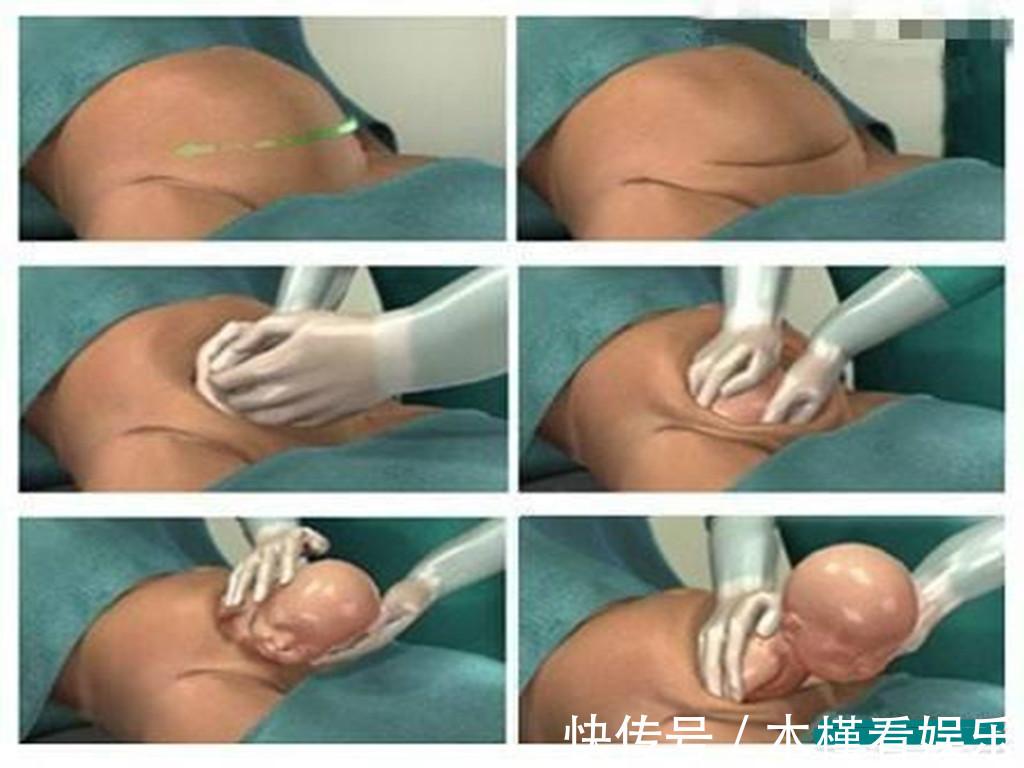 怀孕|别以为怀孕肚子越大胎儿发育越好,合理控制体重,宝宝更健康!