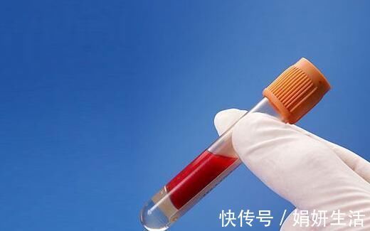 脂质|身体出现这些表现, 是血脂变高的信号, 你有吗