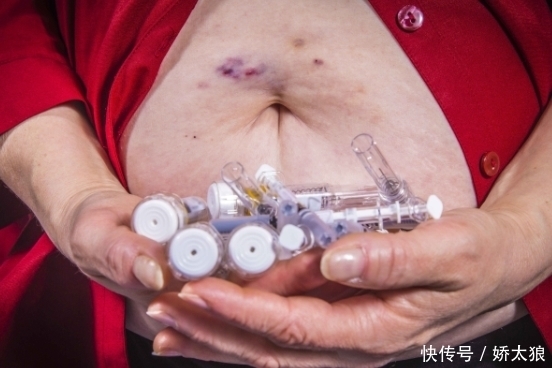  血糖|糖尿病患者不想血糖“升”高，要做好4件事，别不愿意做