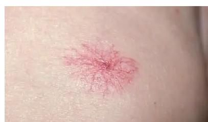 下降|肝不好，脚先知！若脚上出现5种“异常”，说明你的肝越来越差