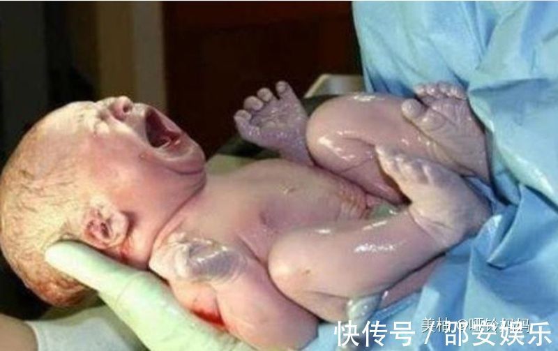 腹直肌|一组图带你了解剖腹产的整个过程:每位产妇都是超人,老公该看看