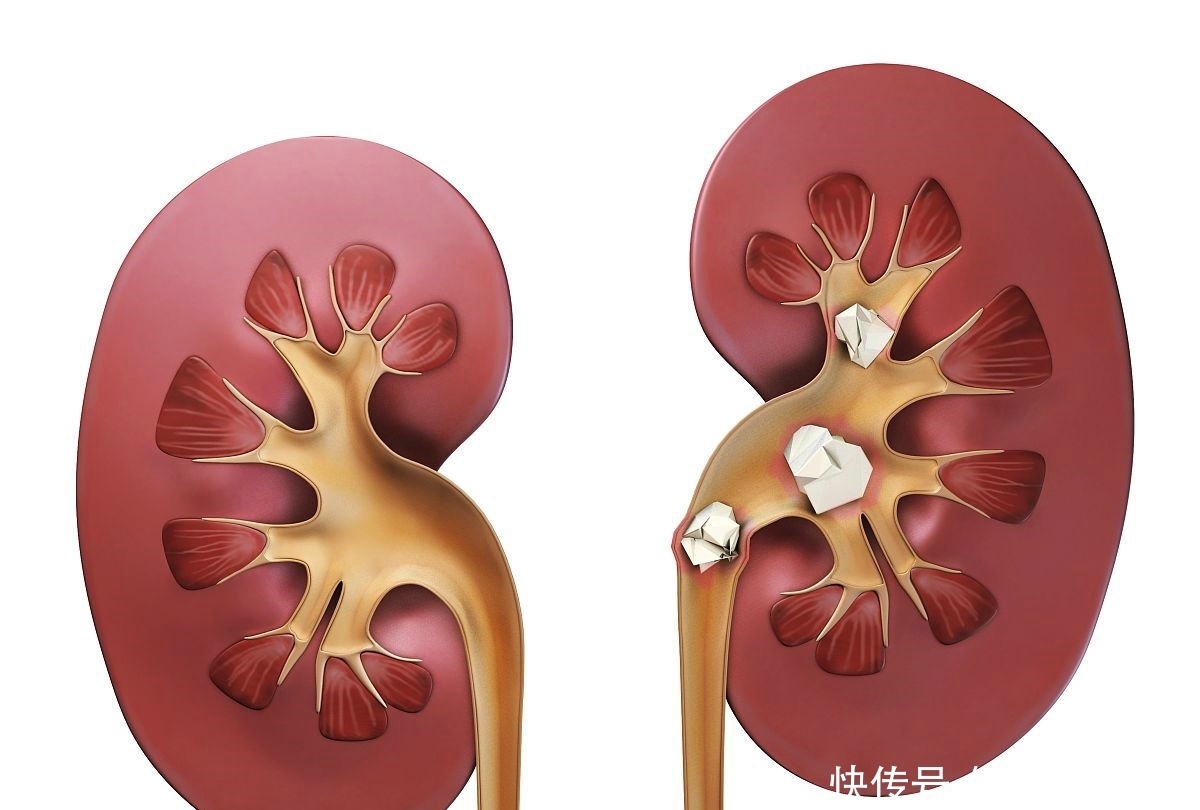 冬季|冬季每天吃20克黑木耳,会收获5个好处,但有1点别忽视