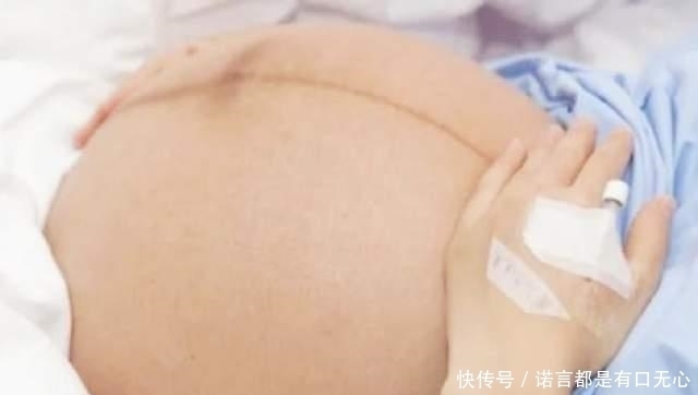 秘密|怀孕后肚子上的“黑线”是什么？妊娠中线的秘密，你有必要了解