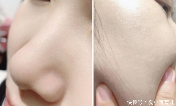 敏感肌|哪些洗面奶已经被拉入“黑名单”,就连“皮肤科医生”都不敢用