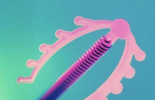 输卵管|生了孩子，医生问需要上环还是结扎，怎么选？这样说的男人值得爱