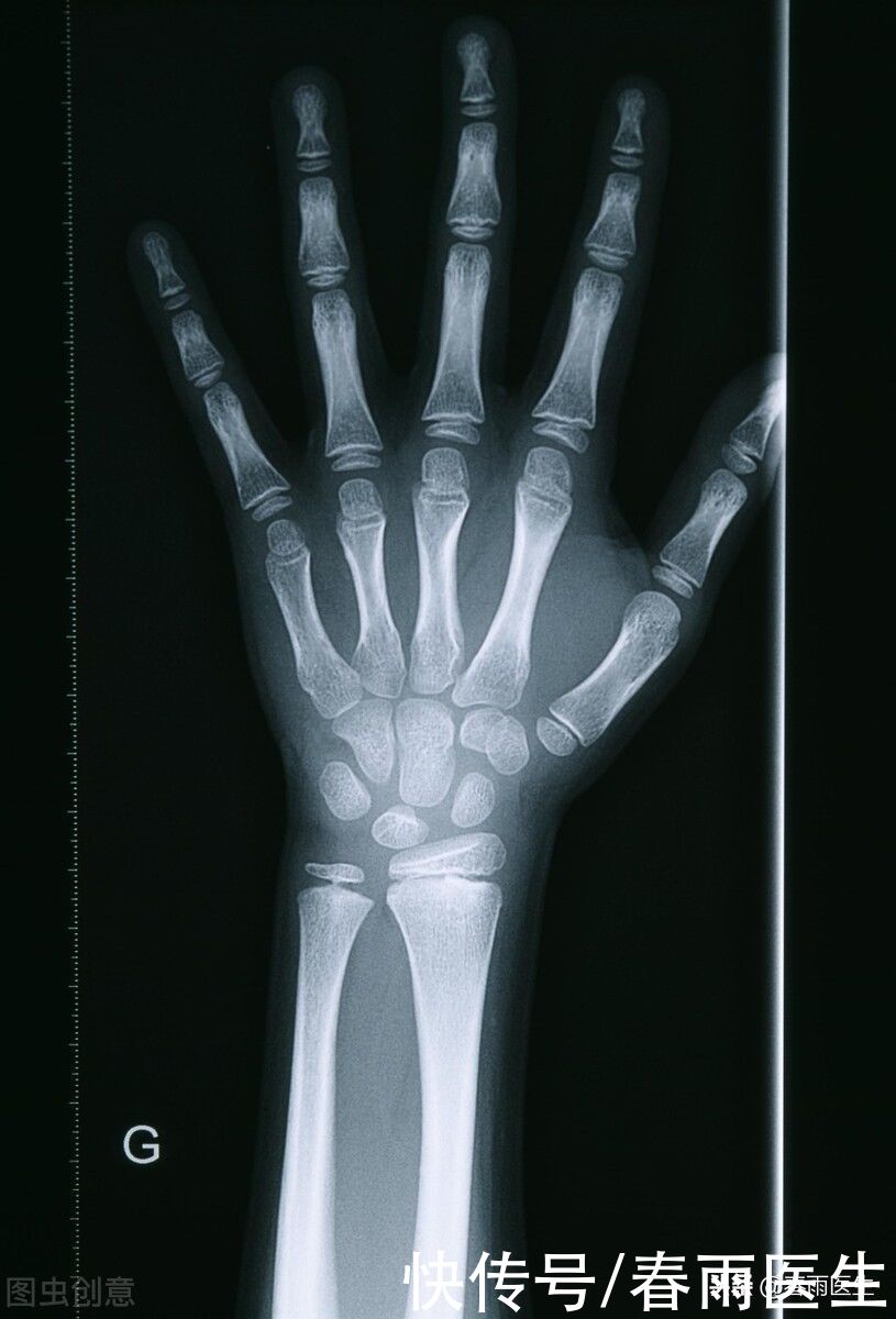 辐射量|父母个子矮，孩子一定长不高吗？做好这3点有可能让孩子“逆袭”