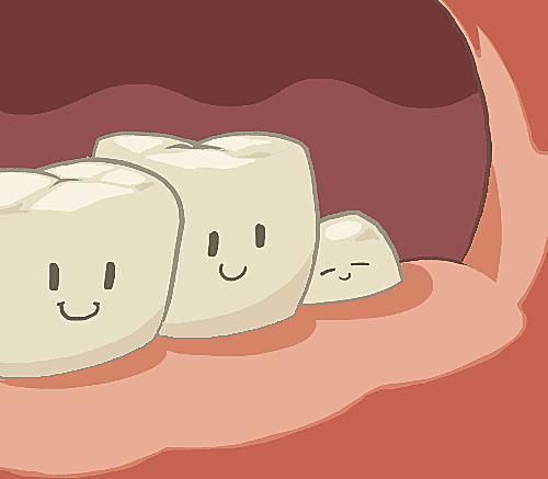 磨牙|来自牙医的忠告：千万别把智齿一次性拔完，真不是想多收钱