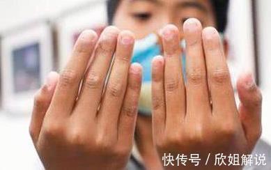 指甲|从小“咬指甲”的孩子,长大后会变成什么样逃不掉这两种结局