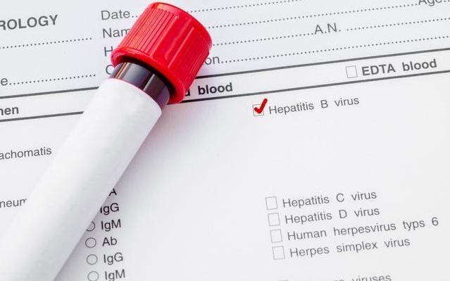 指标|肝功能报告单上，这2两项指标最重要！其中一个超标，都不能大意