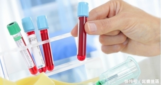 甘油三酯|高血脂的“祸根”并不是肥肉,此物天天吃,多数人忽略了