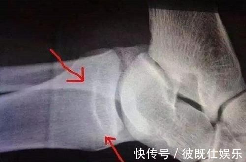 孩子|想让孩子身材高挑,注意这两大“长个子”的征兆,轻松助力他长高