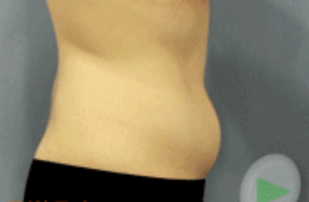 减肥|咖啡减肥法，局部减肥法，这2个减肥误区，你中招了吗？