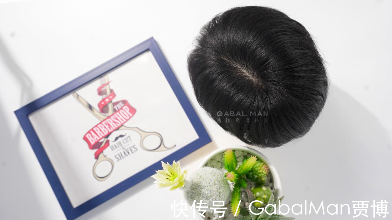 地中海|地中海发型和戴假发,你更不能接受哪个?